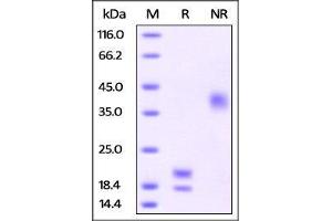 SDS-PAGE (SDS) image for Vascular Endothelial Growth Factor (VEGF) (AA 27-147) (Active) protein (His tag) (ABIN2870705)