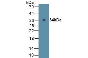 Detection of Recombinant Pgp, Rat using Polyclonal Antibody to Permeability Glycoprotein (Pgp) (Permeability Glycoprotein 抗体  (AA 999-1277))