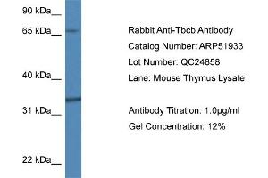 Western Blotting (WB) image for anti-Tubulin Folding Cofactor B (TBCB) (N-Term) antibody (ABIN2784694) (TBCB 抗体  (N-Term))