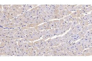 Immunohistochemistry (IHC) image for anti-Sema Domain, Seven Thrombospondin Repeats (Type 1 and Type 1-Like), Transmembrane Domain (TM) and Short Cytoplasmic Domain, (Semaphorin) 5B (SEMA5B) (AA 36-602) antibody (ABIN7428713)