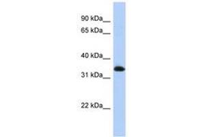 Image no. 1 for anti-Zinc Finger Protein 511 (ZNF511) (N-Term) antibody (ABIN6740520) (ZNF511 抗体  (N-Term))