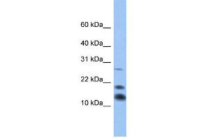 WB Suggested Anti-C1D Antibody Titration:  0. (C1D 抗体  (Middle Region))