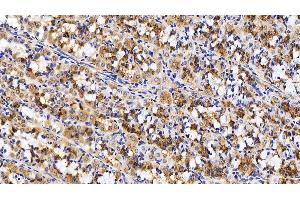 Immunohistochemistry (IHC) image for anti-Kininogen 1 (KNG1) (AA 390-644) antibody (ABIN7433357)