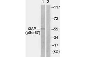 Western blot analysis of extracts from HepG2 cells treated with Anisomycin 25ug/ml 30', using XIAP (Phospho-Ser87) Antibody. (Intestinal Alkaline Phosphatase 抗体  (pSer87))