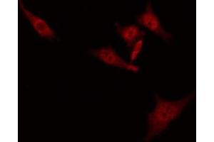 ABIN6274860 staining Hela by IF/ICC. (Aquaporin 12A 抗体  (C-Term))