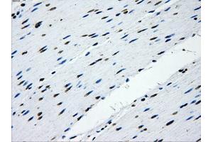 Immunohistochemical staining of paraffin-embedded Kidney tissue using anti-IFIT3mouse monoclonal antibody. (IFIT3 抗体)