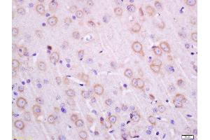 Formalin-fixed and paraffin embedded rat brain labeled with Anti-Transmembrane Protein 30A Polyclonal Antibody, Unconjugated  at 1:200 followed by conjugation to the secondary antibody and DAB staining. (TMEM30A 抗体  (AA 251-350))