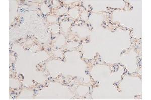 ABIN6267555 at 1/200 staining Rat lung tissue sections by IHC-P.