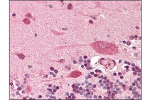 Immunohistochemistry (IHC) image for anti-Podoplanin (PDPN) (AA 1-206), (N-Term) antibody (ABIN302234) (Podoplanin 抗体  (N-Term))