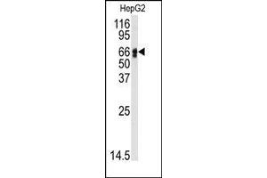 Image no. 1 for anti-Angiotensinogen (serpin Peptidase Inhibitor, Clade A, Member 8) (AGT) (N-Term) antibody (ABIN360211)
