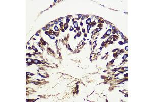 Immunohistochemistry of paraffin-embedded Rat testis using  Rabbit pAb (ABIN6133192, ABIN6137243, ABIN6137244 and ABIN6223255) at dilution of 1:100 (40x lens). (ATG10 抗体  (AA 1-220))