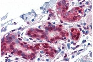 Human Breast: Formalin-Fixed, Paraffin-Embedded (FFPE) (YAP1 抗体  (AA 53-162))