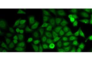 Immunofluorescence analysis of HeLa cells using IMPDH2 Polyclonal Antibody (IMPDH2 抗体)