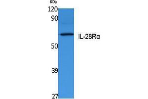 Western Blotting (WB) image for anti-Interleukin 28 Receptor, alpha (Interferon, lambda Receptor) (IL28RA) (Internal Region) antibody (ABIN3178120) (IL28RA 抗体  (Internal Region))