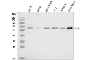 Western blot analysis of YY1 using anti-YY1 antibody (ABIN7602999).