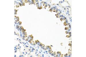 Immunohistochemistry of paraffin-embedded mouse lung using TICAM1 antibody. (TICAM1 抗体)