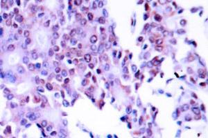 Image no. 1 for anti-Nuclear Factor-kB p65 (NFkBP65) antibody (ABIN271748) (NF-kB p65 抗体)