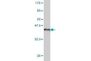 Western Blotting (WB) image for anti-Sema Domain, Immunoglobulin Domain (Ig), Transmembrane Domain (TM) and Short Cytoplasmic Domain, (Semaphorin) 4D (SEMA4D) (AA 115-224) antibody (ABIN564579)