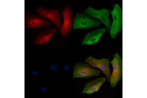 ABIN6263951 and ABIN6272734 staining  cells by IF/ICC. (LPAR6 抗体  (Internal Region))