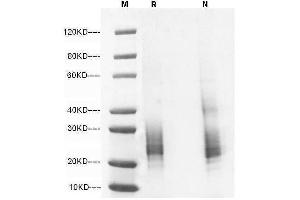 5 μg of IL-7,His, Mouse  was resolved with SDS-PAGE under reducing (R) and non-reducing (N) conditions and visualized by Coomassie Blue staining. (IL-7 Protein (AA 26-154) (His tag))