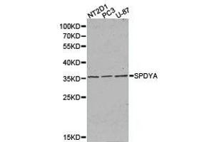 Western Blotting (WB) image for anti-Speedy Homolog A (SPDYA) antibody (ABIN1874919) (SPDYA 抗体)