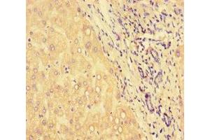 Immunohistochemistry of paraffin-embedded human liver tissue using ABIN7154859 at dilution of 1:100 (HSPA13 抗体  (AA 23-471))