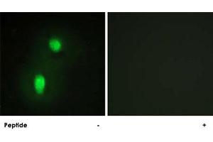Immunofluorescence analysis of HUVEC cells, using HNRNPC polyclonal antibody . (HNRNPC 抗体)