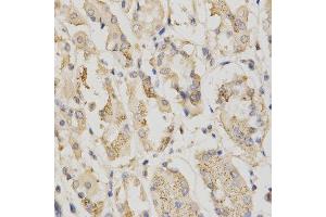 Immunohistochemistry of paraffin-embedded human stomach using STK11 antibody at dilution of 1:200 (x400 lens) (LKB1 抗体  (AA 134-433))