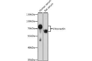 Western blot analysis of extracts of various cell lines, using Vitronectin antibody (ABIN3022357, ABIN3022358, ABIN3022359 and ABIN6218758) at 1:1000 dilution. (Vitronectin 抗体  (AA 364-478))