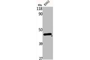 Western Blot analysis of K562 cells using DHS Polyclonal Antibody