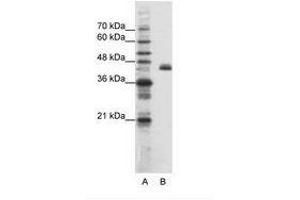 Image no. 1 for anti-Zinc Finger Protein 36, C3H Type-Like 2 (ZFP36L2) (N-Term) antibody (ABIN202655) (ZFP36L2 抗体  (N-Term))