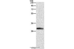 Western blot analysis of Mouse heart tissue, using DCK Polyclonal Antibody at dilution of 1:550 (DCK 抗体)
