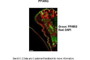 Mouse cornea and eyelid Primary Antibody Dilution: 1:100Secondary Antibody: Goat anti-rabbit-AlexaFluor-546 Secondary Antibody Dilution: 1:0000Color/Signal Descriptions: PPARG: Green DAPI: Red  Gene Name: Ppar Gamma  Submitted by: Anonymous (PPARG 抗体  (N-Term))