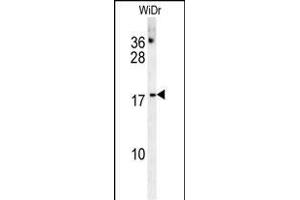 CHCHD2 Antibody (Center) (ABIN654013 and ABIN2843939) western blot analysis in WiDr cell line lysates (35 μg/lane). (CHCHD2 抗体  (AA 74-103))