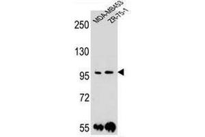 PCDH1 Antibody (N-term) western blot analysis in MDA-MB453,ZR-75-1 cell line lysates (35µg/lane). (Protocadherin 1 抗体  (N-Term))