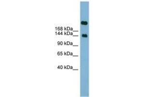 Image no. 1 for anti-Sucrase-Isomaltase (Alpha-Glucosidase) (SI) (AA 1691-1740) antibody (ABIN6742020) (Sucrase Isomaltase 抗体  (AA 1691-1740))