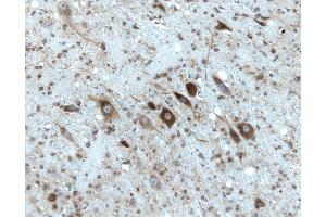 Rat cerebellum, formalin-fixed paraffin embedded tissue, with citrate pre-treatment, 20X. (Gephyrin 抗体  (AA 569-726))