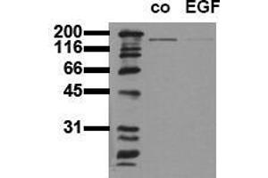 Western Blotting (WB) image for anti-Epidermal Growth Factor Receptor (EGFR) (Tyr1197) antibody (ABIN126780) (EGFR 抗体  (Tyr1197))