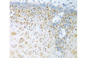 Immunohistochemistry of paraffin-embedded Human esophagus using FDXR Polyclonal Antibody at dilution of 1:100 (40x lens). (Ferredoxin Reductase 抗体)