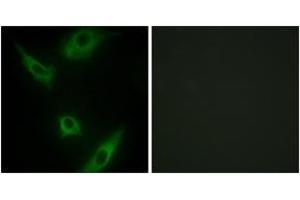 Immunofluorescence analysis of HeLa cells, using MAP3K1 Antibody. (MAP3K1 抗体  (AA 181-230))