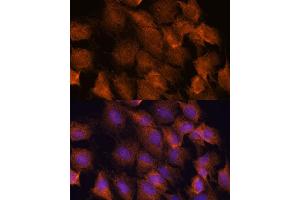 Immunofluorescence analysis of C6 cells using SCRN3 antibody (ABIN7270176) at dilution of 1:100. (Secernin 3 抗体  (AA 100-410))