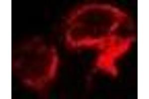 Immunofluorescent analysis of OSGEPL1 staining in A549 cells. (OSGEPL1 抗体)