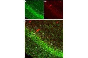 Expression of CB1 receptor in rat hippocampusImmunohistochemical staining of rat hippocampus using Anti-Cannabinoid Receptor 1 (extracellular) Antibody (ABIN7043023, ABIN7044155 and ABIN7044156) (1:100). (Cannabinoid Receptor 1 (CNR1) Peptide)
