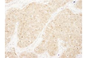 Immunohistochemistry (IHC) image for anti-Mitogen-Activated Protein Kinase 3 (MAPK3) (AA 329-379) antibody (ABIN7448555)