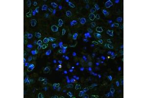 IF analysis of Emerin using anti-Emerin antibody (ABIN4886569).