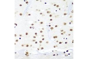 Immunohistochemistry of paraffin-embedded mouse brain using HTATSF1 antibody at dilution of 1:100 (40x lens). (HTATSF1 抗体)