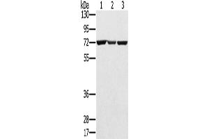 Western Blotting (WB) image for anti-Solute Carrier Family 25, Member 13 (Citrin) (slc25a13) antibody (ABIN2424163) (slc25a13 抗体)