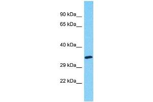 Western Blotting (WB) image for anti-Myeloid-Associated Differentiation Marker-Like 2 (MYADML2) (C-Term) antibody (ABIN2791681) (MYADML2 抗体  (C-Term))