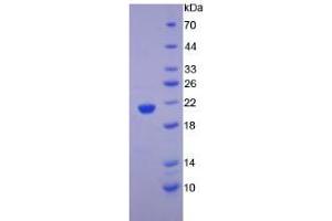 SDS-PAGE analysis of Human alpha Fodrin Protein. (SPTAN1 蛋白)