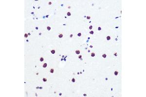 Immunohistochemistry of paraffin-embedded rat brain using P Rabbit mAb (ABIN7269445) at dilution of 1:100 (40x lens). (PABPN1 抗体)
